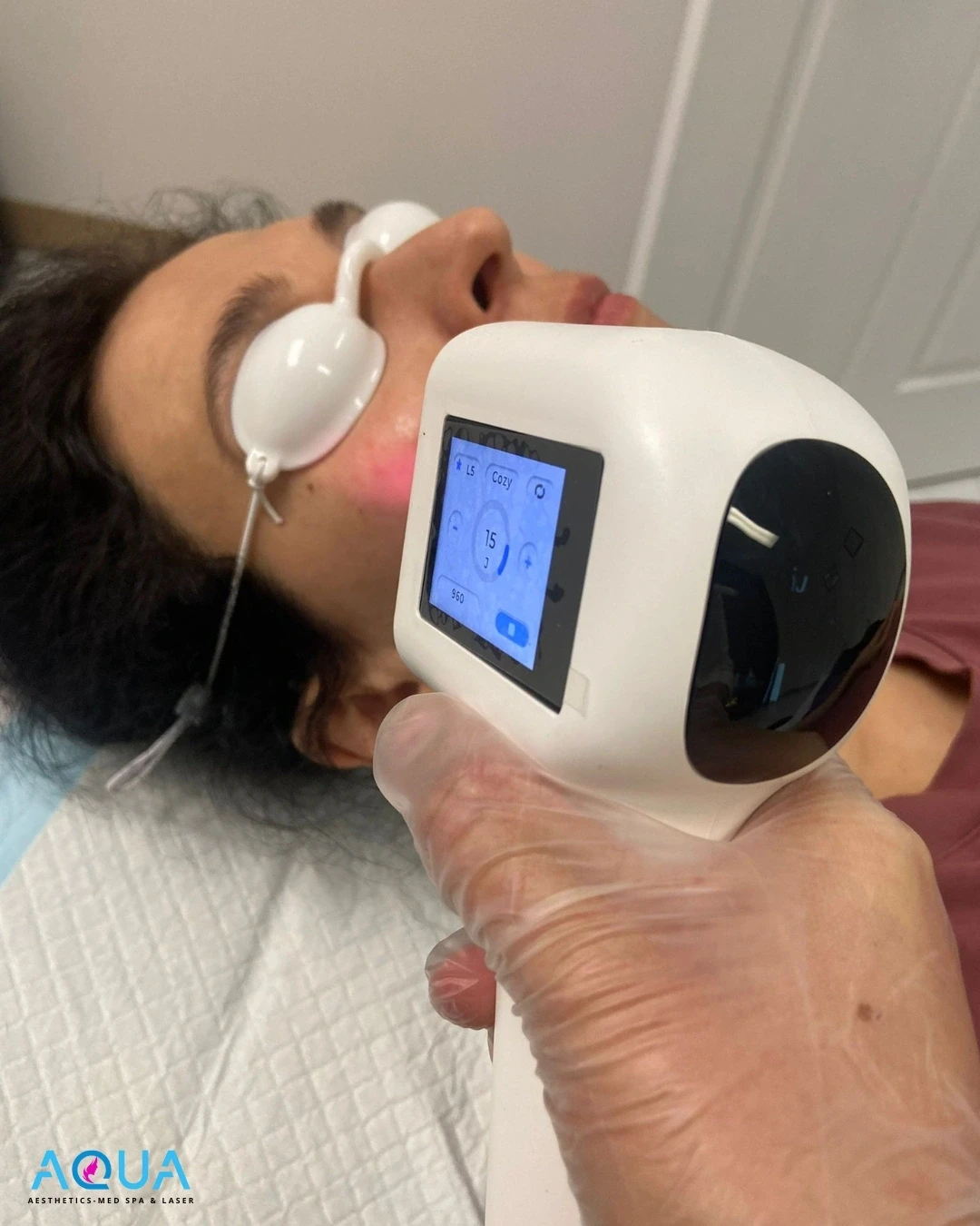 Laser Hair Removal — Aqua Aesthetics Med Spa Edmonton